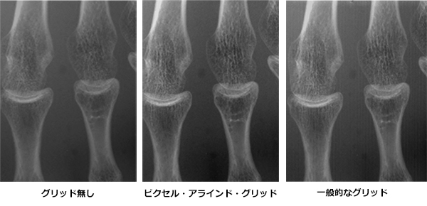 ピクセル・アラインド・グリッド