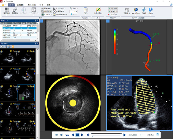 DICOMビューワ「GoodView」シリーズ