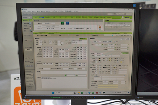 レポートシステム「G-Record」の心カテ台帳
