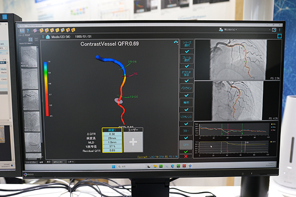 定量的冠血流量比解析プログラム「Medis QFR」