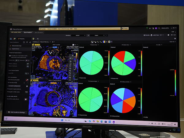 「MR Cardiac Suite」のマッピング解析