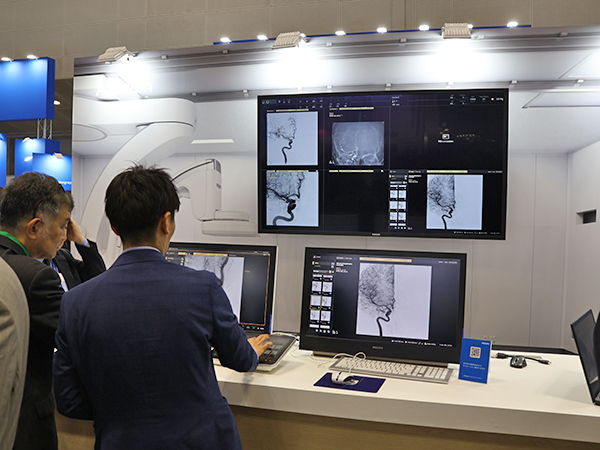 インターフェイスを操作可能なシミュレータで紹介した「Azurion」