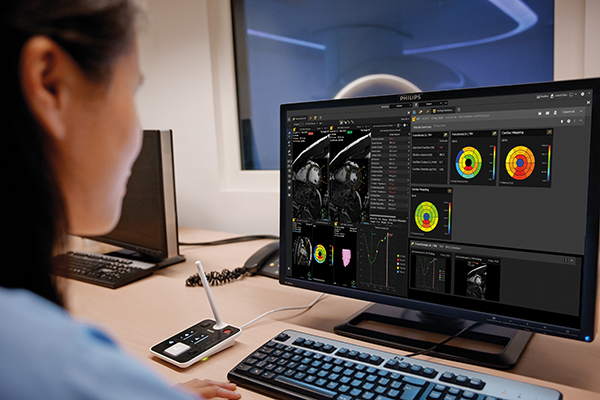 フィリップス Advanced Visualization Workspace