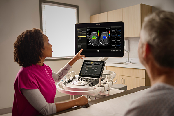 超音波画像診断装置　EPIQ／Affiniti