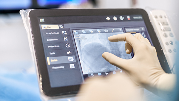 Azurion 7シリーズに搭載可能なTouch Screen Module Pro