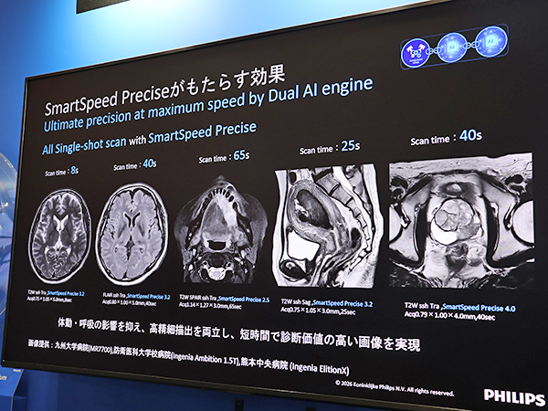 Dual AIエンジン「SmartSpeed Precise」では高速撮像と高画質化を両立
