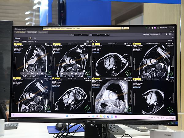 トレースが自動化された心臓MRI解析アプリケーション「MR Cardiac Suite」