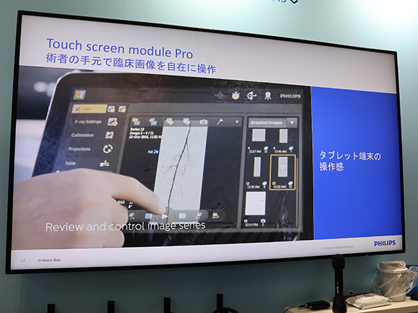 ベッドサイドで画像の操作・解析が可能な「Touch Screen Module Pro」