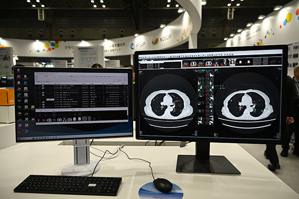 「NOBORI Viewer」とキヤノンメディカルシステムズの解析用ビューワ「Findings Workflow」のシームレスな連携が可能