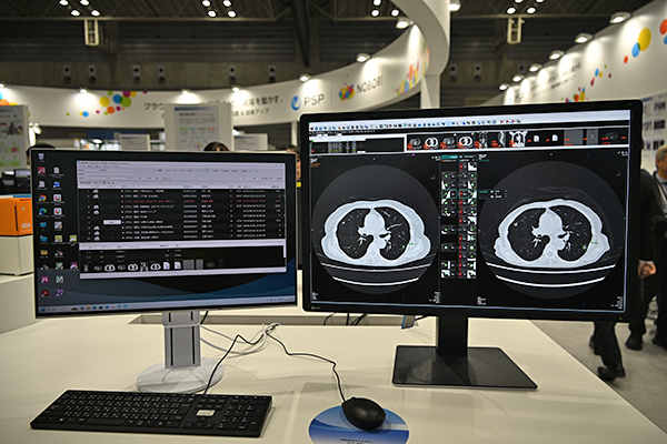「NOBORI Viewer」の「FWC解析表示」機能は胸部CT画像診断支援ソフトウェア「VUNO Med-LungCT AI」にも対応