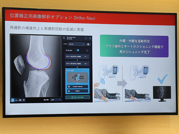 AIで膝関節側面撮影を支援する位置補正用画像解析ソフトウエア「Ortho-Navi」
