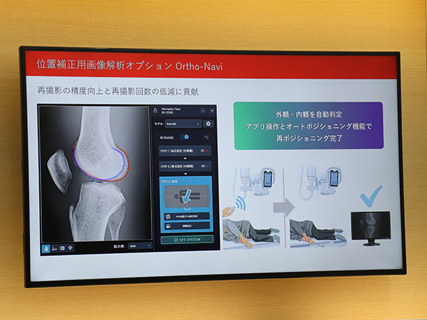 Ortho-Naviではアプリ操作とオートポジショニング機能で再ポジショニングを完了
