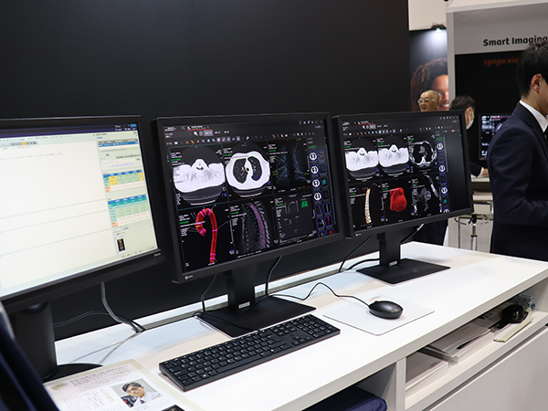 統合型医療情報プラットフォーム「Syngo Carbon」