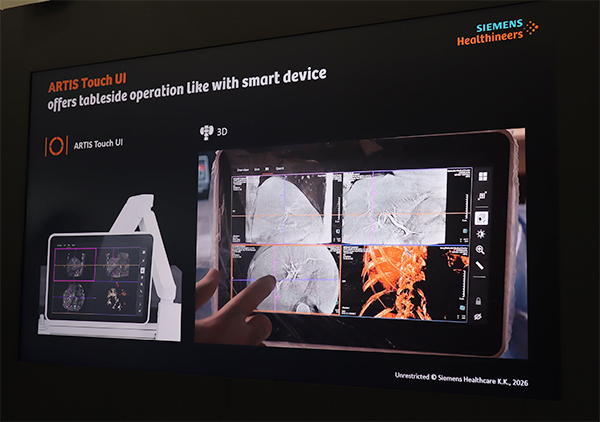 ARTIS Touch UIでは3D画像の操作も可能