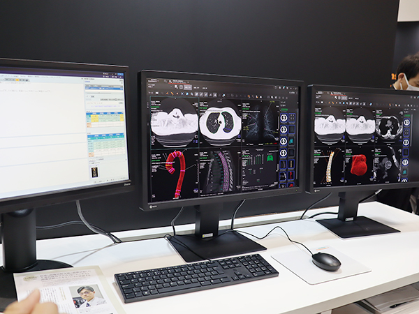 Syngo Carbonに統合された「AI-Rad Companion」の「Chest CT」での解析結果