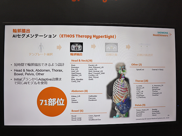 コンツーリングにおけるAIセグメンテーションの対応部位