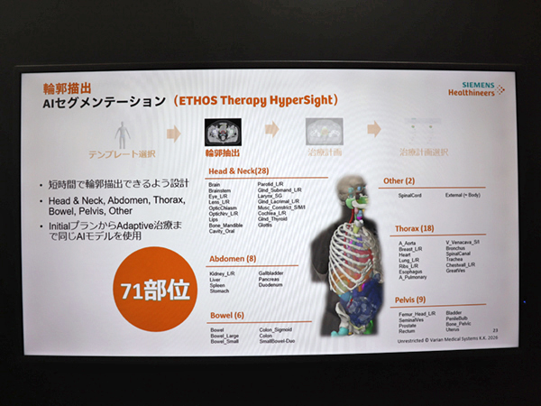 「ETHOS Therapy HyperSight」のv2.0では，自動輪郭抽出の対象部位が71部位に拡大