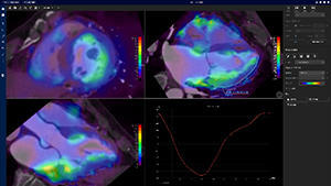 2Dモーション解析