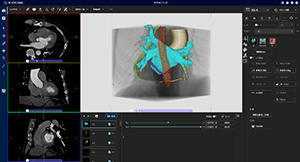 EPプランニング