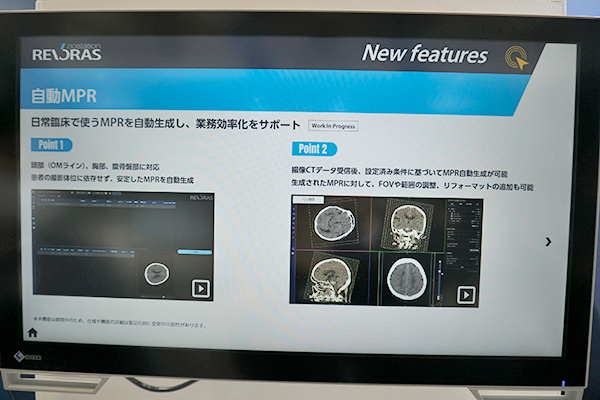 自動MPR・頭部（OMライン）