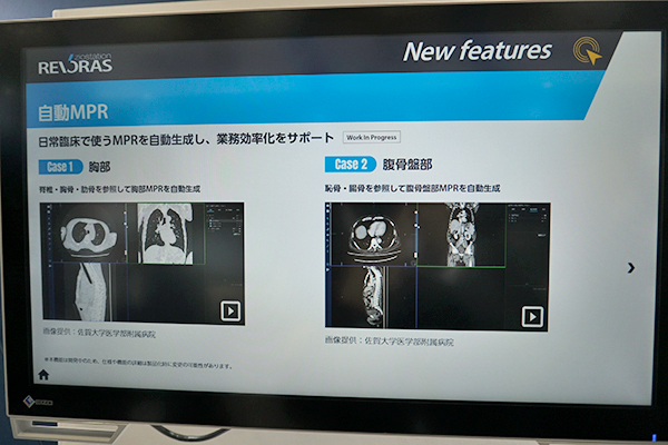 自動MPR・胸部，腹骨盤部
