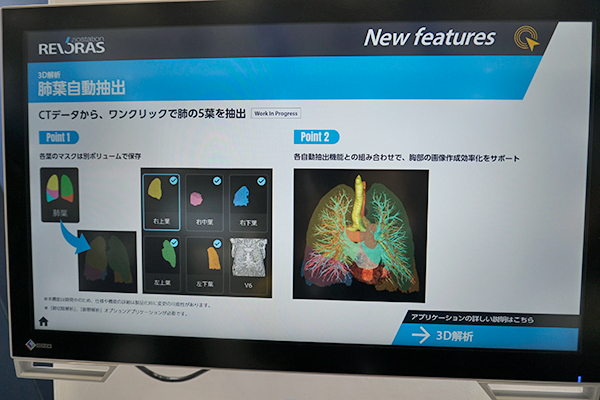 3D解析・肺葉自動抽出