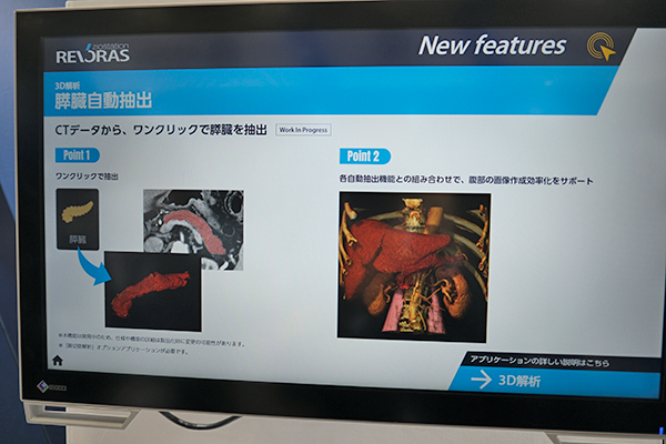 3D解析・膵臓自動抽出
