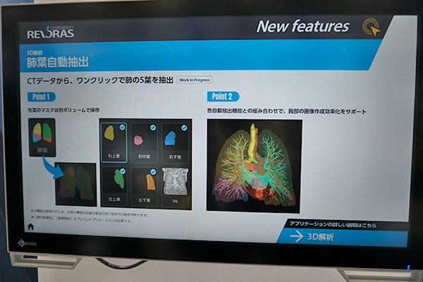 3D解析・肺葉自動抽出