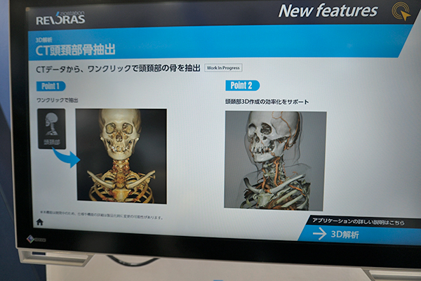 3D解析・CT頭頸部骨抽出