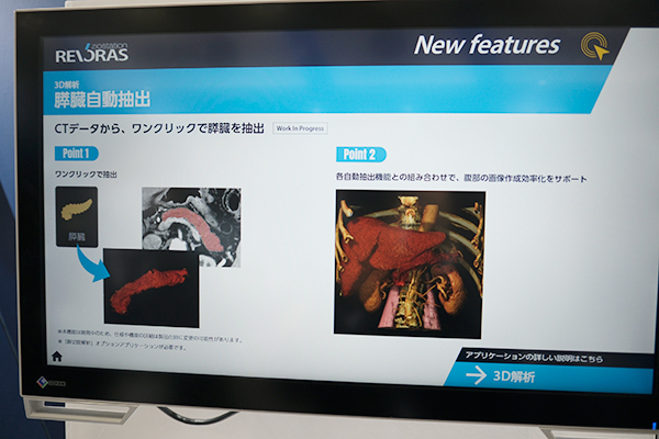 3D解析・膵臓自動抽出