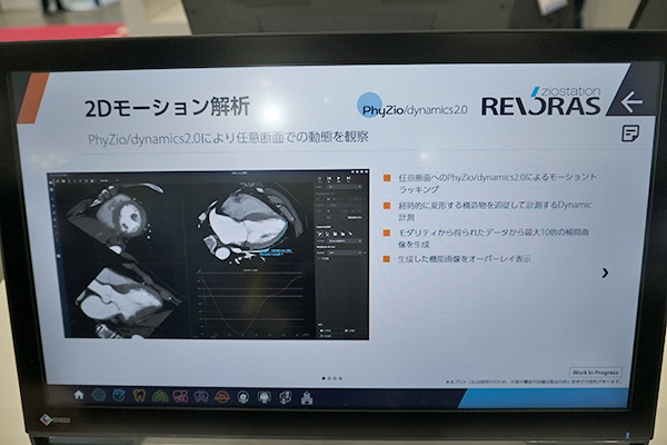 PhyZio/dynamics2.0による2Dモーション解析（W.I.P.）