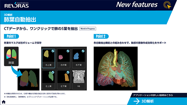 3D解析・肺葉自動抽出