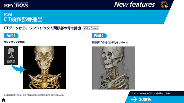 3D解析・CT頭頚部骨抽出