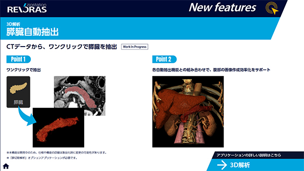3D解析・膵臓自動抽出