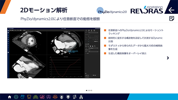 PhyZio/dynamics2.0による2Dモーション解析