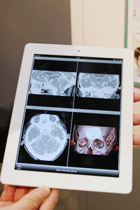 タブレット端末やスマートフォンで画像参照が可能「SYNAPSE ERm」