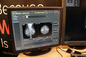 自動認識機能で患者ごとのシェーマを自動生成「AMULET Bellus」