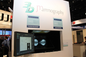 読影ワークステーションに対応した3D Mammography