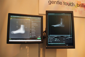 トモシンセシスを紹介