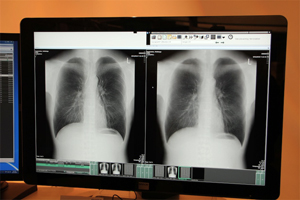 エネルギーサブトラクション