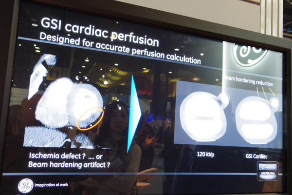 GSIによる心臓パーフュージョン像の紹介