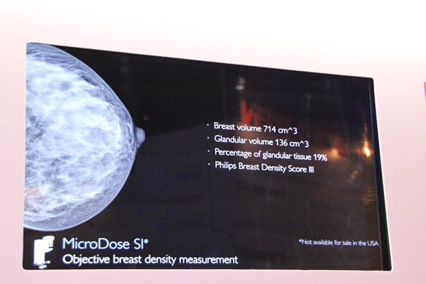 Spectral Imagingによる“breast density measurement”（W.I.P.）