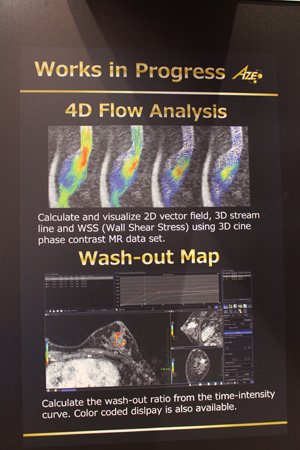 4D Flow AnalysisとWash-out Map