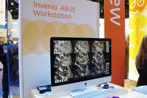 検査画像はすぐにInvenia ABUS Workstationに表示