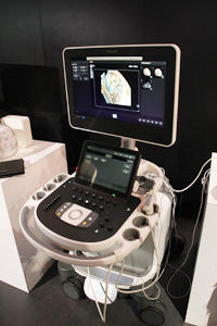 プレミアム超音波診断装置の新製品である「EPIQ」
