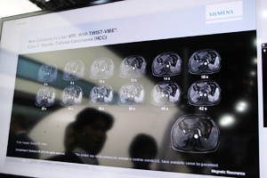 1フェーズあたり2.5秒の高速シーケンス“TWIST-VIBE”