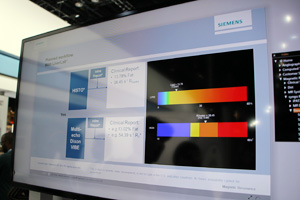 脂肪，鉄分を自動判定する“LiverLab”