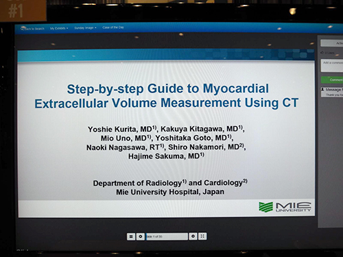 Step-by-step Guide to Myocardial Extracellular Volume Measurement Using CT 栗田　仁衣（三重大学大学院医学系研究科放射線医学教室）