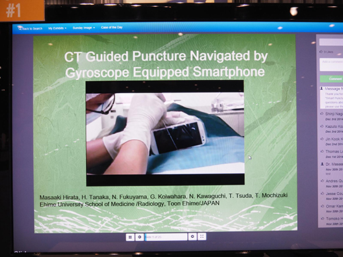 CT Guided Puncture Navigated by Gyroscope Equipped Smartphone 平田雅昭（愛媛大学大学院医学系研究科放射線計医学）