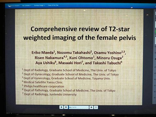 Comprehensive Review of T2-Star Weighted Imaging of the Female Pelvis 前田恵理子（東京大学医学部放射線医学教室）